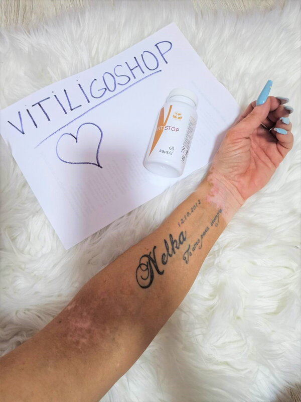 Vitistop Pillole